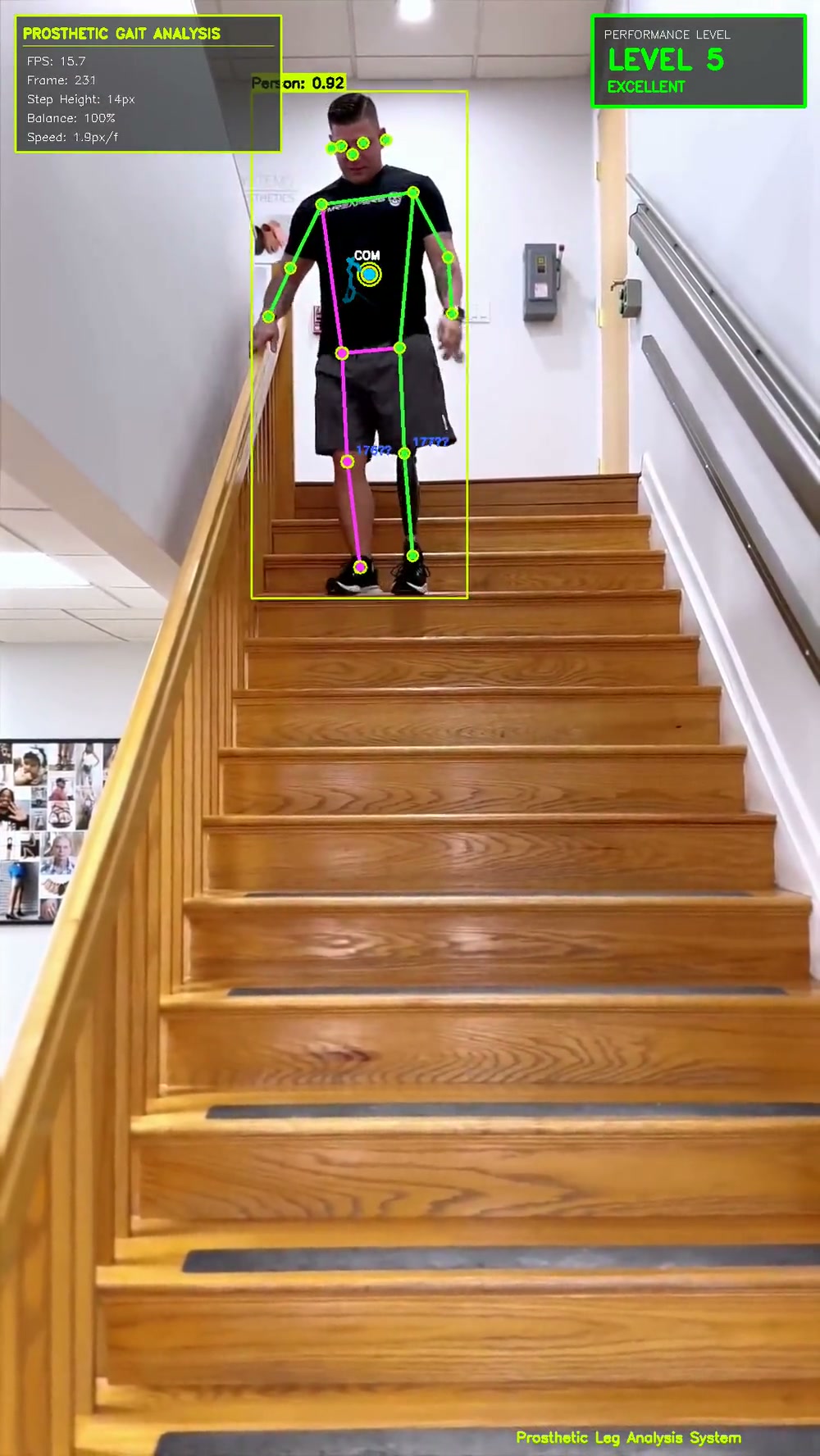 Prosthetic Gait Analysis